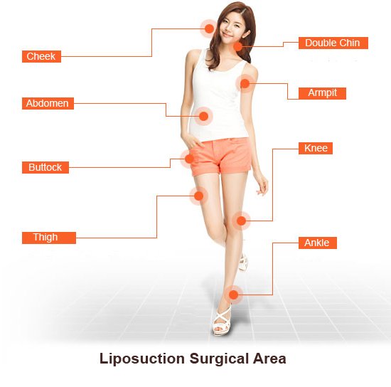 Full Body Liposuction Cost